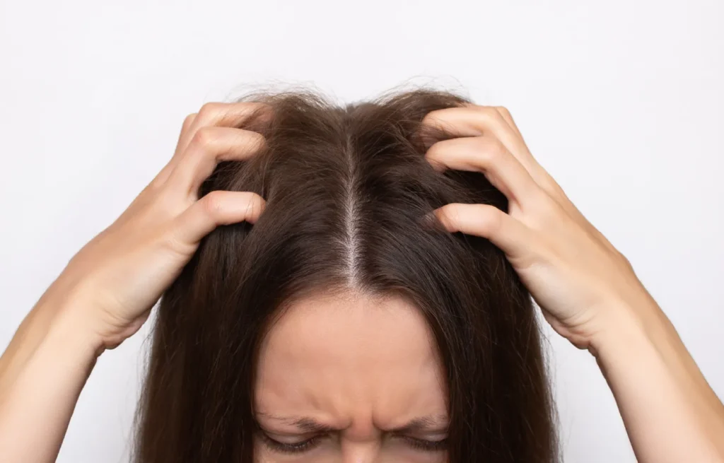 Femeie cu mătreață își scarpină scalpul din cauza mâncărimii intense